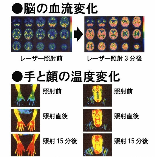 近赤外線　電子灸　星状神経にも 近赤外線治療（スーパーライザー） | 赤羽耳鼻咽喉科クリニック